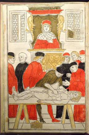 A woodblock from a German manuscript (1493) on medical techniques. Photo: Adel Gorgy